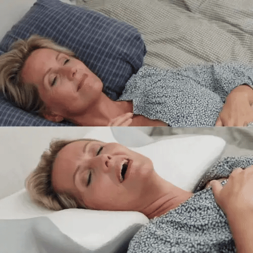 Serenight™ – Úľava pre krk