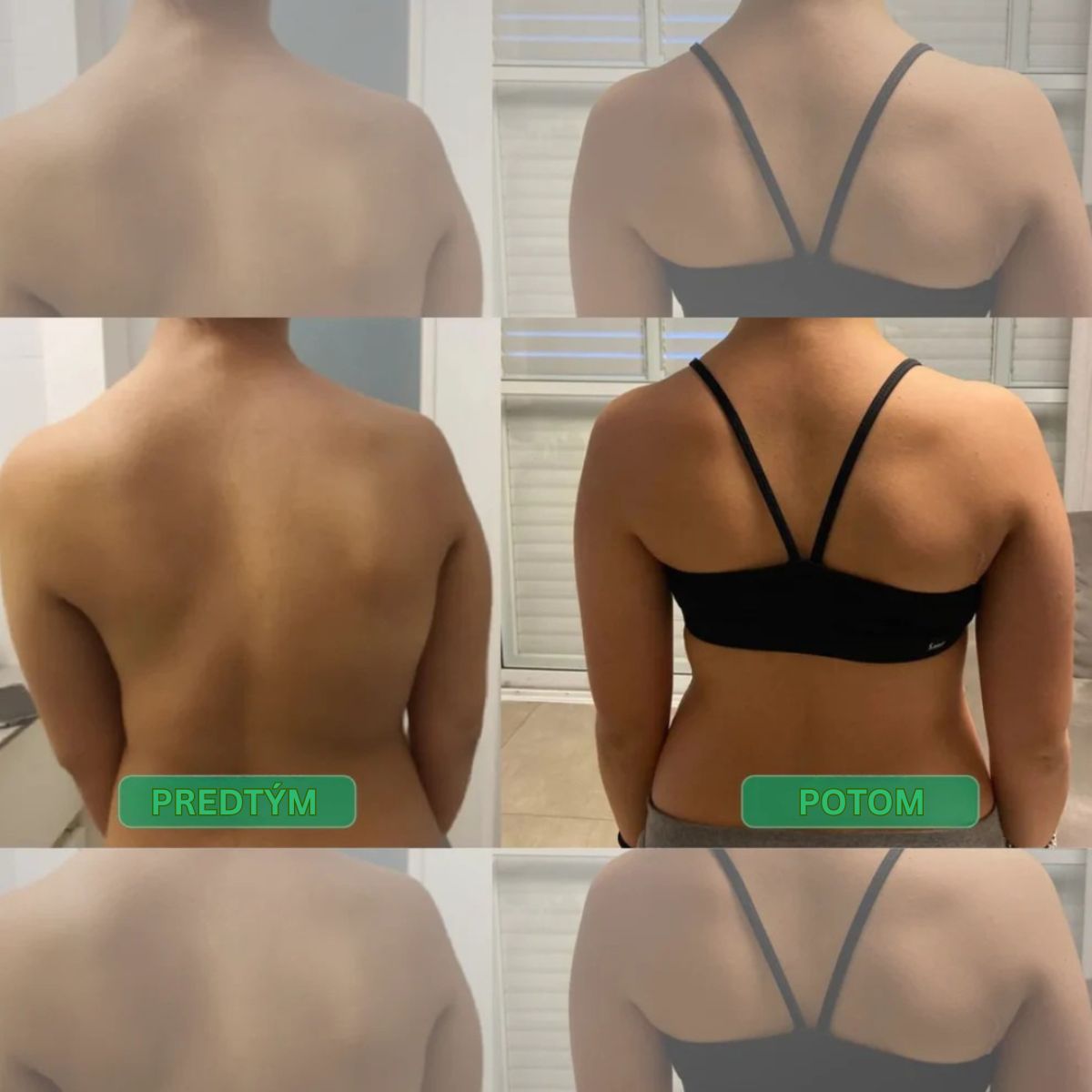 Korektor držania tela s okamžitým účinkom – Postav sa rovno. Uľav si od bolesti chrbta. Pocíť rozdiel už od prvého dňa.