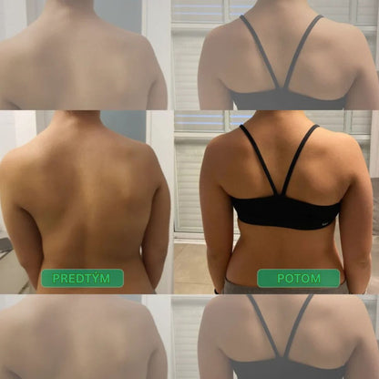 Korektor držania tela s okamžitým účinkom – Postav sa rovno. Uľav si od bolesti chrbta. Pocíť rozdiel už od prvého dňa.