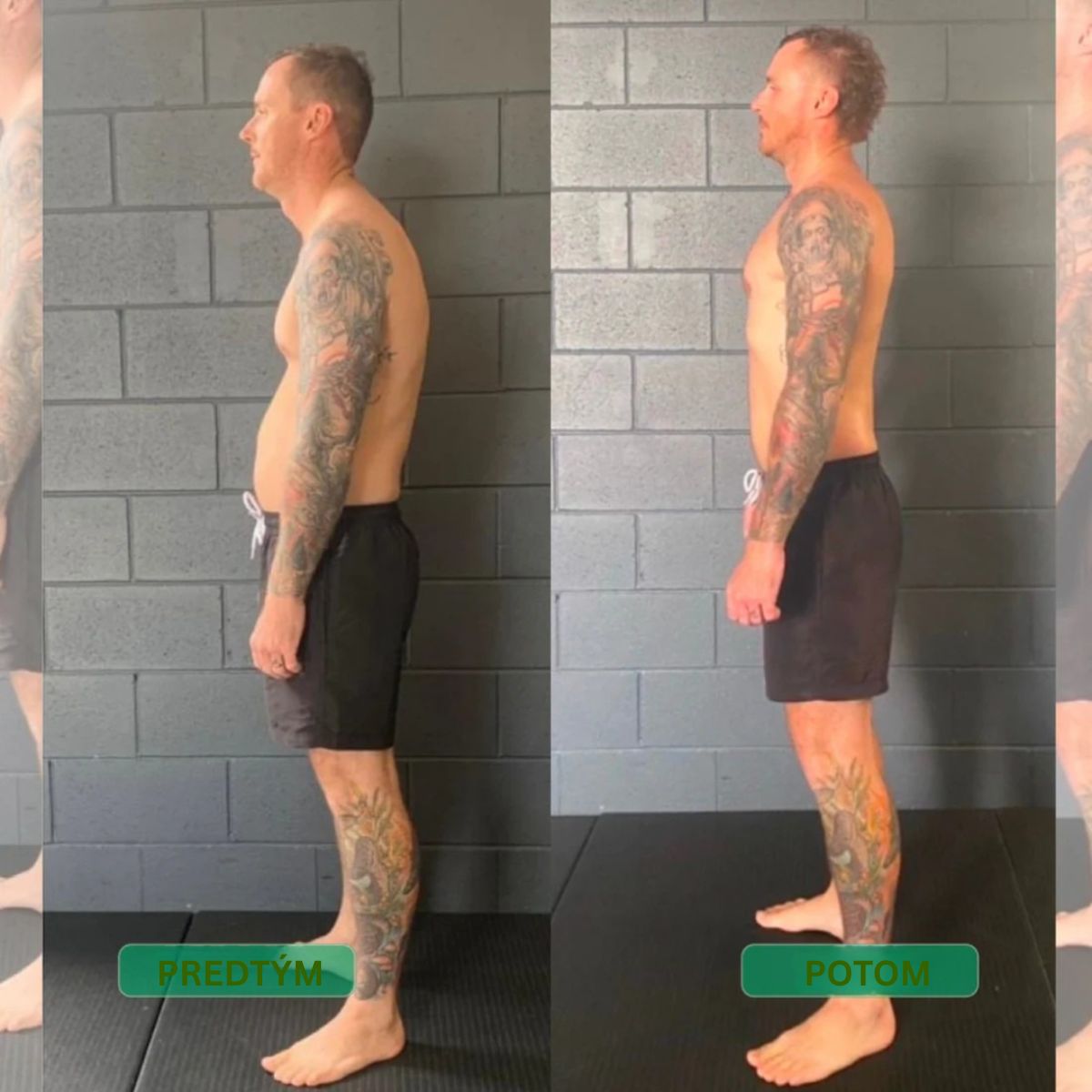 Korektor držania tela s okamžitým účinkom – Postav sa rovno. Uľav si od bolesti chrbta. Pocíť rozdiel už od prvého dňa.