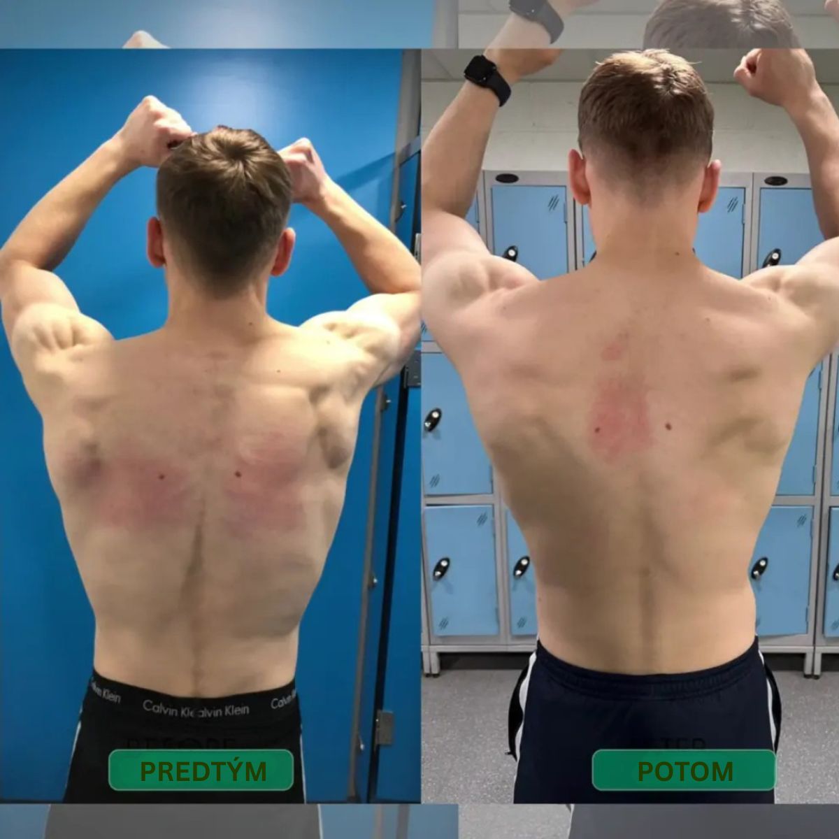 Korektor držania tela s okamžitým účinkom – Postav sa rovno. Uľav si od bolesti chrbta. Pocíť rozdiel už od prvého dňa.