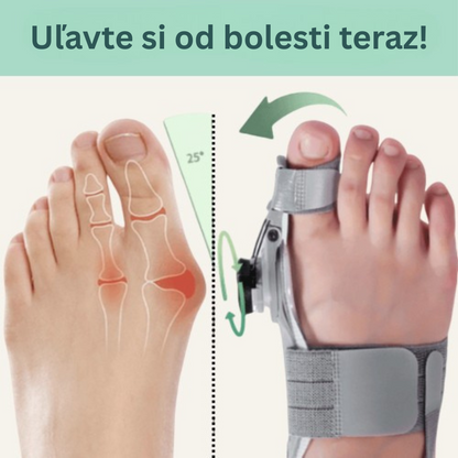 Liečebný balík na vybočený palec (Hallux Valgus)