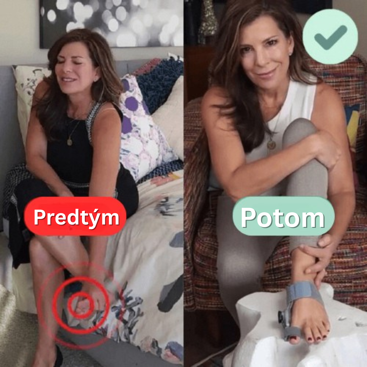 Liečebný balík na vybočený palec (Hallux Valgus)