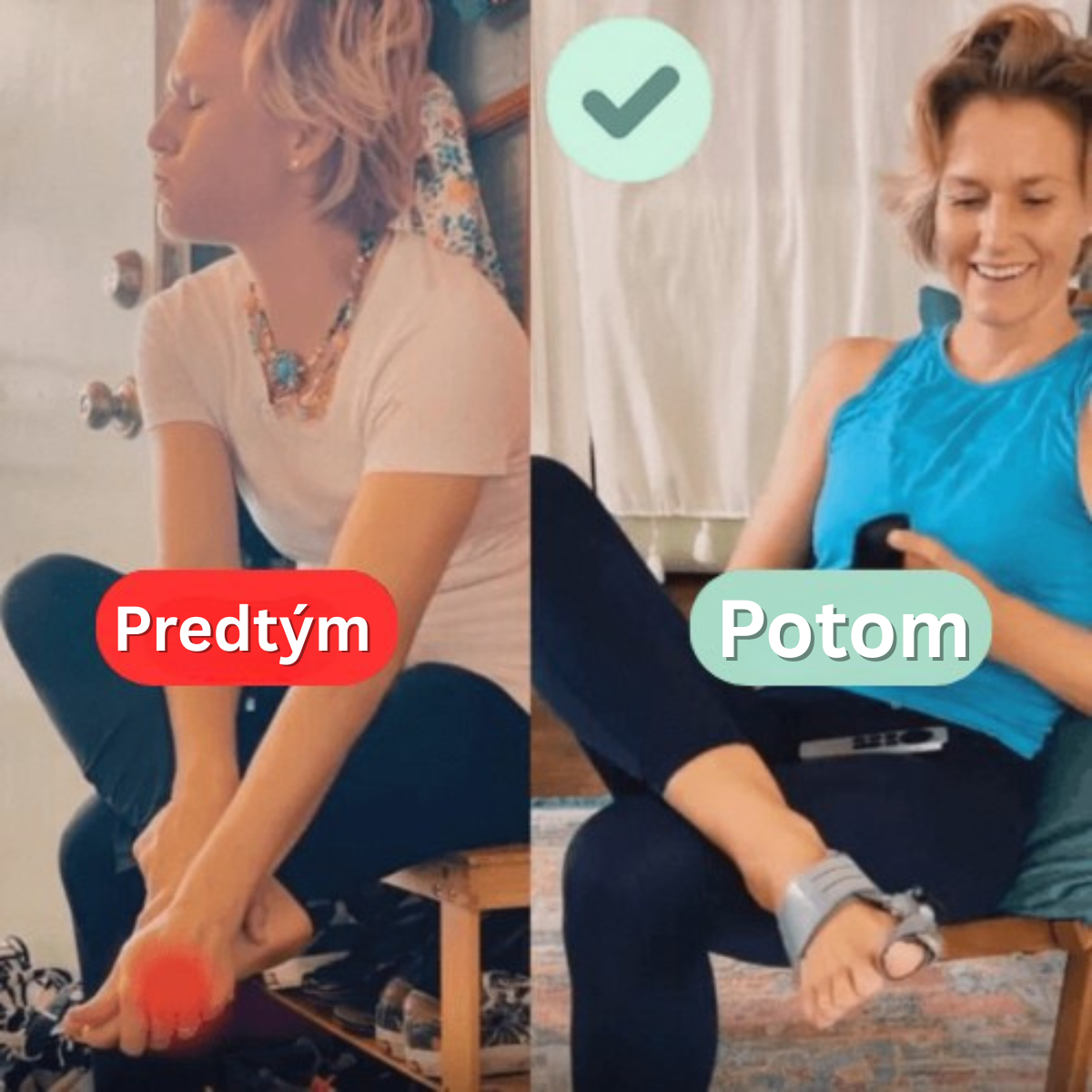 Liečebný balík na vybočený palec (Hallux Valgus)